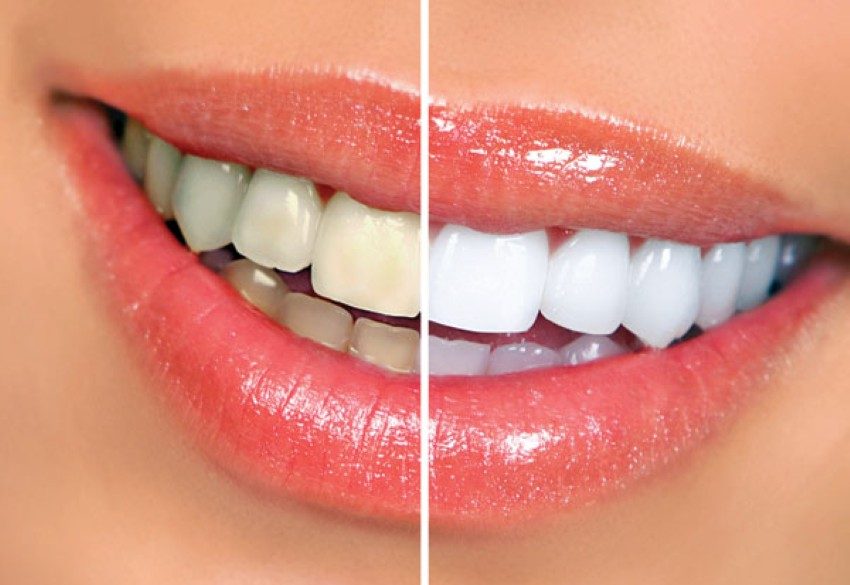 beyaz (Özel)