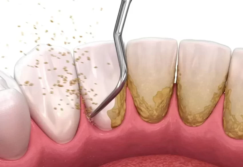 periodontoloji-1024x768